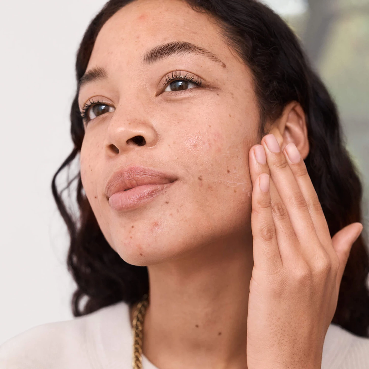 Blemish Rescue Sérum Anti-Imperfections 2 Blemish Rescue Sérum Anti-Imperfections – Image 2