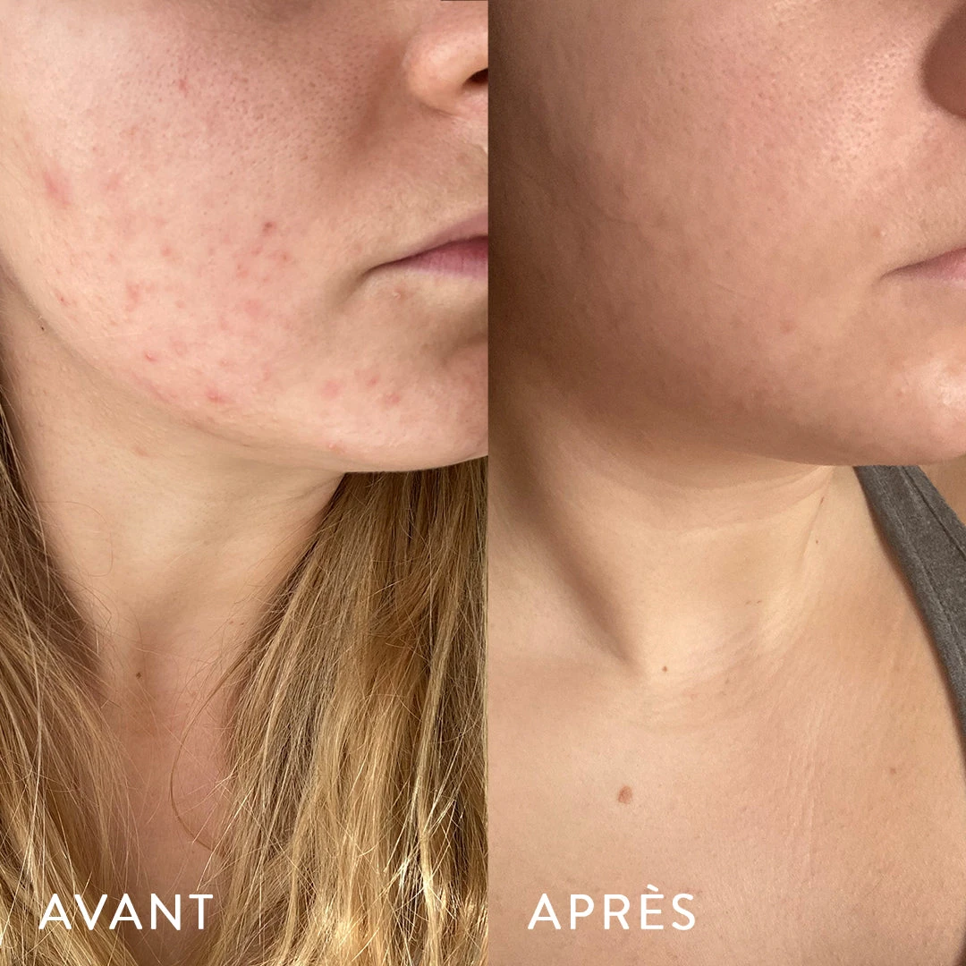 Microbiote & Peau 3 Microbiote & Peau – Image 3